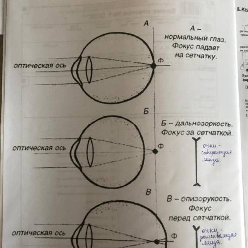 Изображение далеко стоящего предмета, воспринятое с оптической системы глаза, получилось перед сетча