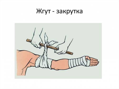 Вместо жгута можно использовать: а. давящую повязку б. закрутку в. холод к ране г. компресс