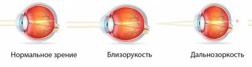 Доклад по биологии 8 класс на тему : глазные заболивания