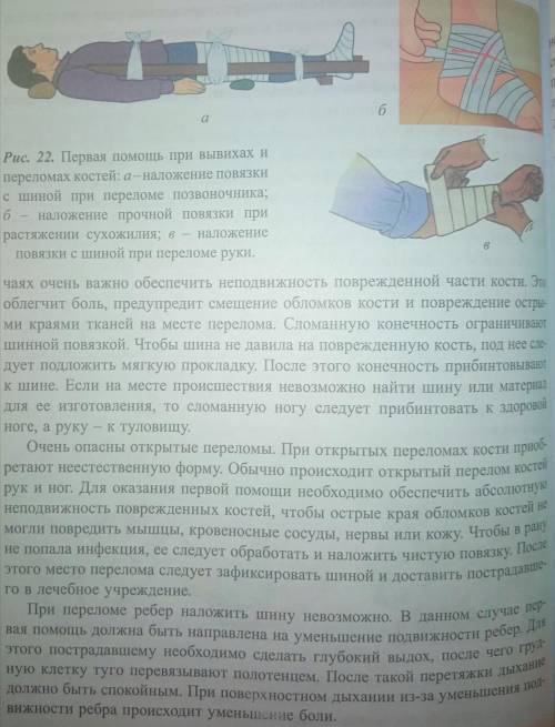 Обоснование правил при1)растяжение2)ударе3) вывихе4) переломе​