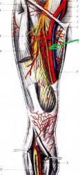Как называется артерия, отмеченная на рисунке зелѐной стрелкой? 1. общая подвздошная 2. наружная