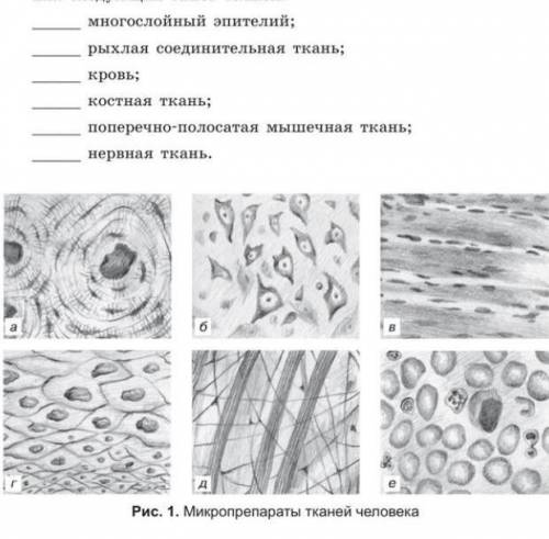 Расмотрите изображение микропрепоратов тканей человека, напишите буквы, обозначающие изображения сле