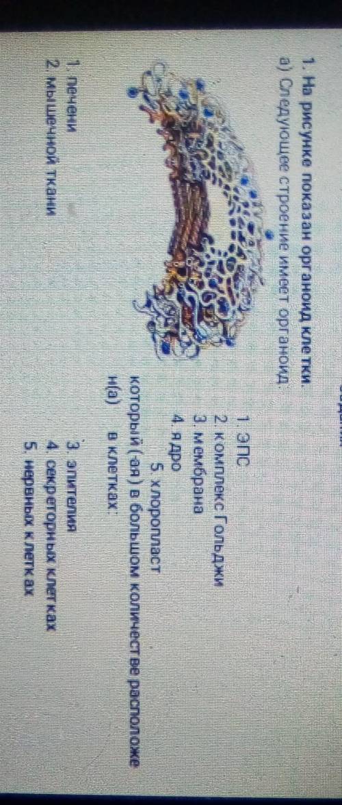 1. На рисунке показан органоид клетки. а) Следующее строение имеет органоид.1. ЭПС2. комплекс Гольдж