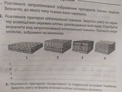 Подпишите виды эпителию на рисунку