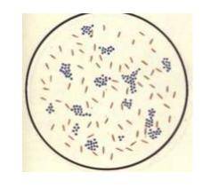 Определите вид бактерий окрашенных в сине- фиолетовый цвет. Определите грамм положительные или грамм