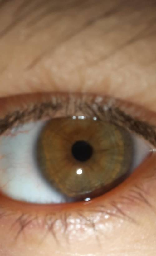 Что это за цвет глаз? ​