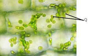 На рисунке видна растительная клетка под микроскопом. Рассмотри рисунок и ответь на вопрос. elodea00