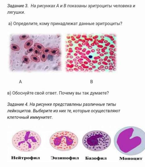 нужно, у меня сейчас СОР Задание 2. Выберите три верных ответа. К функциям крови относят:1) транспор