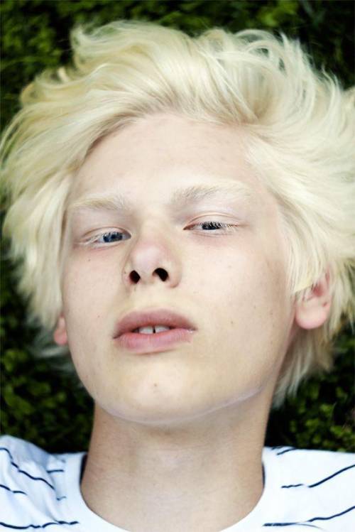 Отец натуральный солнечный блондин с синими глазами, у матери неполный альбинизм, пепельно-соломенны