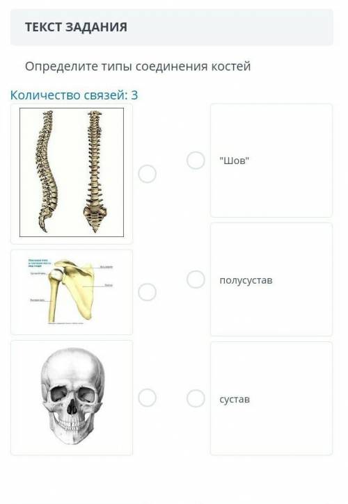 Определите типы соединений костей.СОЧ Биология​