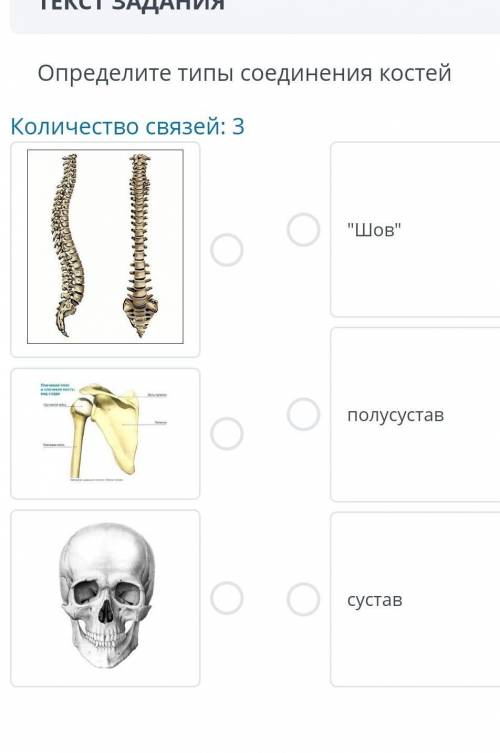 Определите типы соединения костей ​