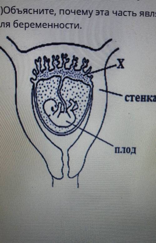 3.На рисунке показано развитие зародыша внутри матки. A) Назовите часть, обозначенную под буквой Х.В