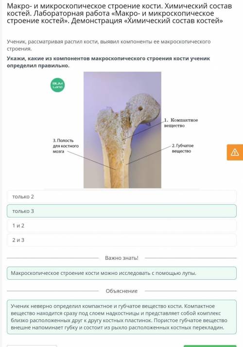 Ученик, рассматривая распил кости, Выявил компоненты ее макроскопического строения. Укажи, какие из